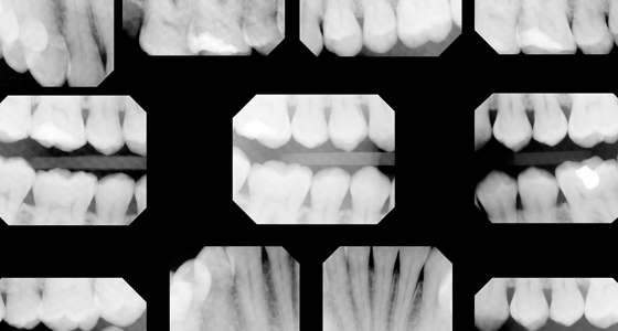 11476-6 History-XRay-560x300.jpg