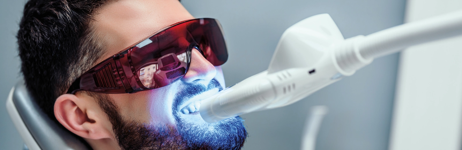 man-getting-teeth-whitened-1600x522.webp