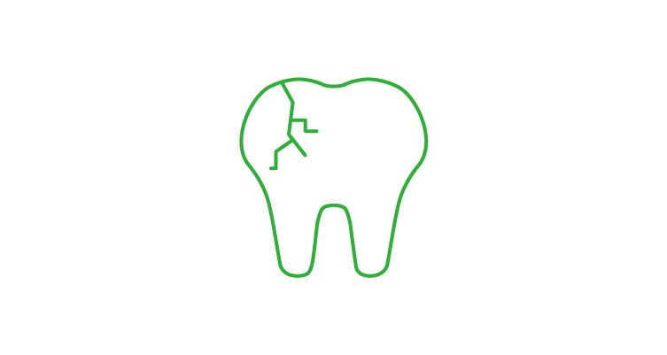 cracked-tooth-icon-752x400.webp