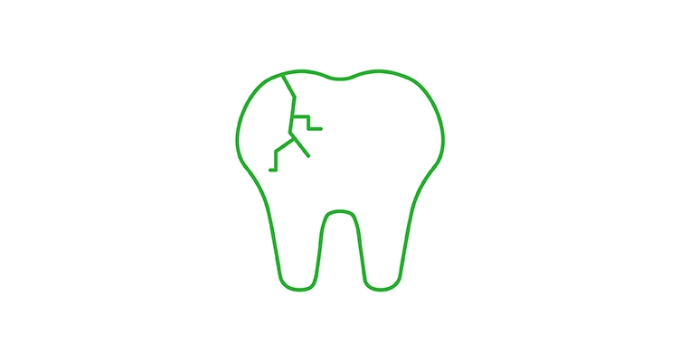 cracked-tooth-icon-752x400.webp