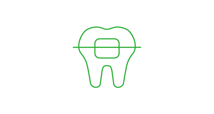 braces-icon-752x400.webp