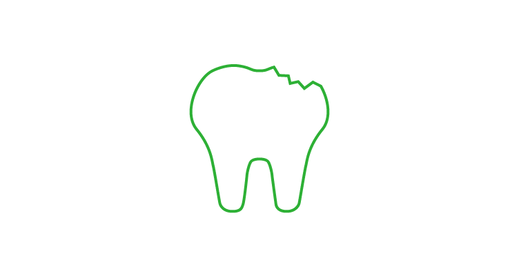 chipped-tooth-icon-752x400.webp