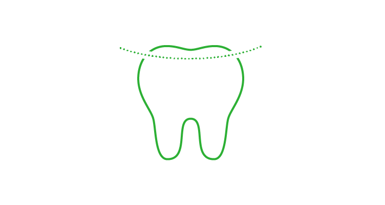 tooth-shaping-icon-752x400.webp