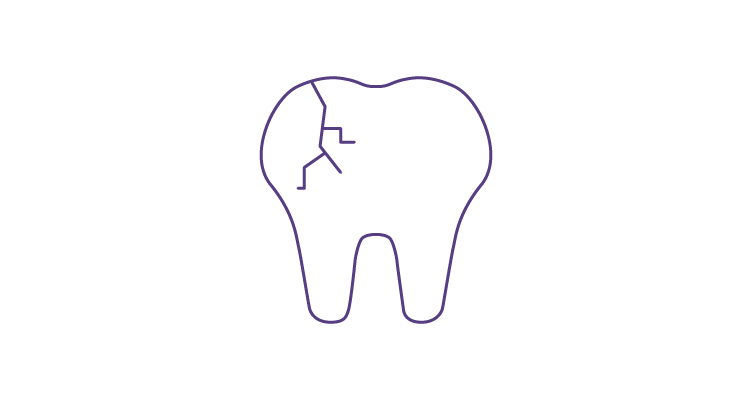 broken-teeth-icon-752x400.png