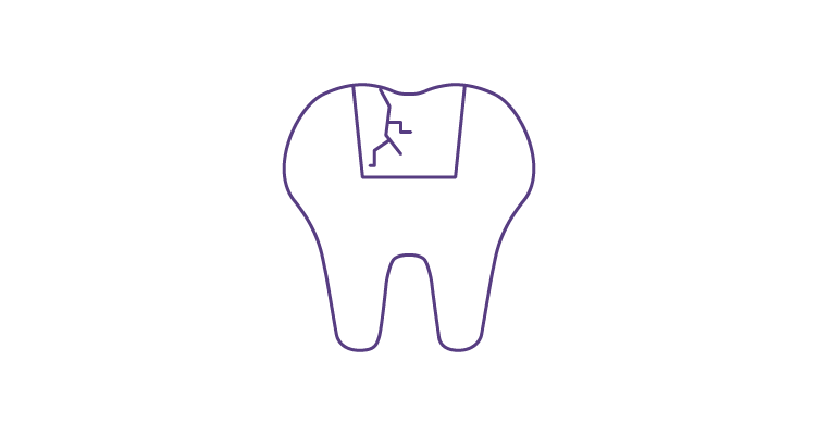 damaged-fillings-icon-752x400.png